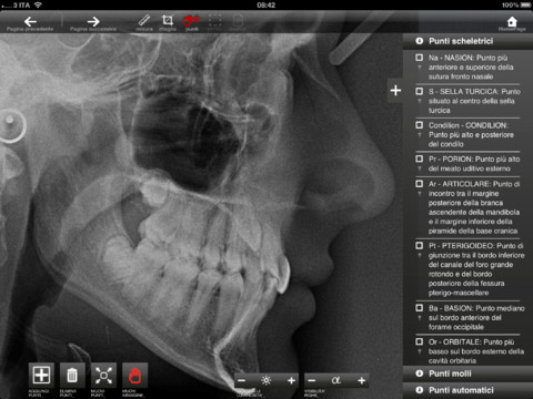 SmileCeph: la nuova app dedicata ai dottori odontoiatri